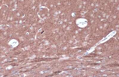 Immunohistochemistry-Paraffin: PKC epsilon [p Ser729] Antibody [NBP3-13312] - Mouse brain. PKC epsilon (phospho Ser729) stained by PKC epsilon (phospho Ser729) antibody (NBP3-13312) diluted at 1:500. Antigen Retrieval: Citrate buffer, pH 6.0, 15 min.